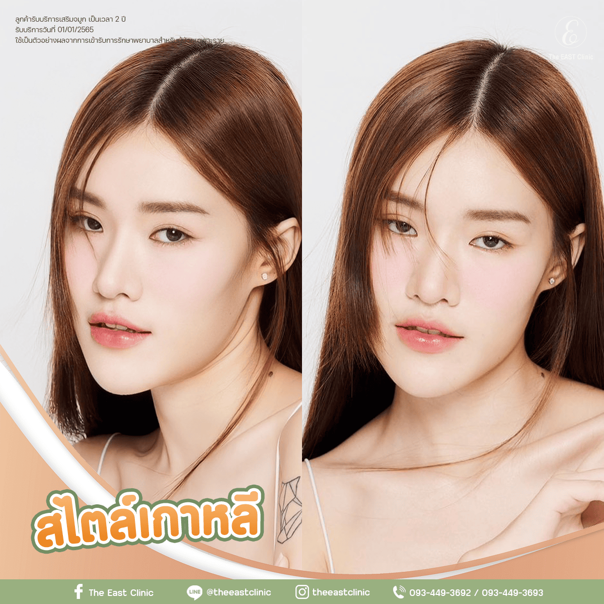 ตัวอย่างจมูกทรงสไตล์เกาหลี